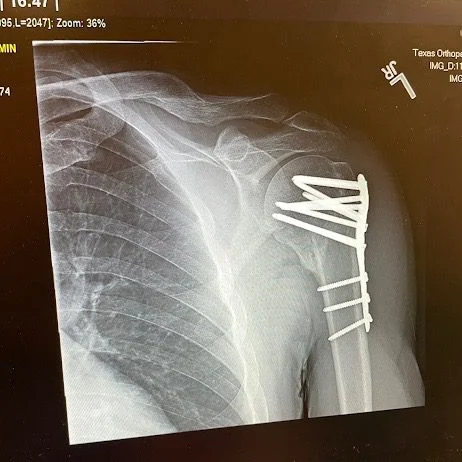 An X-ray